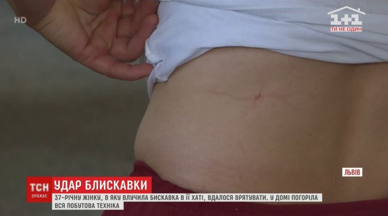 Гроза на Львівщині: через розетку блискавка влучила в жінку, яка була в хаті