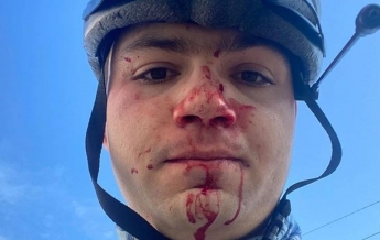 У Києві побили велосипедиста, який завадив машині проїхати по тротуару